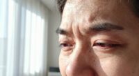 bright light causes eye discomfort